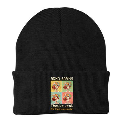 Adhd Brains Theyre Real And Theyre Spectacular Neurodiversity Knit Cap Winter Beanie
