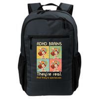 Adhd Brains Theyre Real And Theyre Spectacular Neurodiversity Backpack