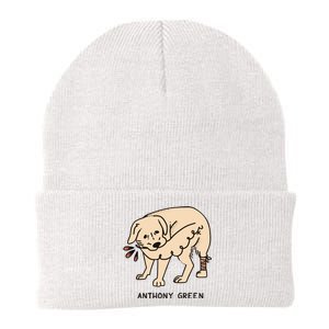 Anthony Green Numb Knit Cap Winter Beanie