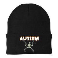 Autism Skeleton Meme Beanie