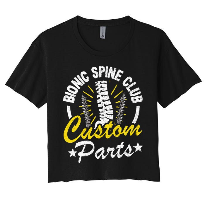 Bionic Spine Club Customs Parts Funny Back Surgery Recovery Crop Top