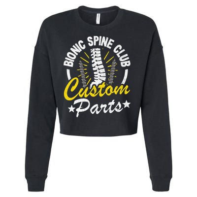 Bionic Spine Club Customs Parts Funny Back Surgery Recovery Cropped Pullover Crew