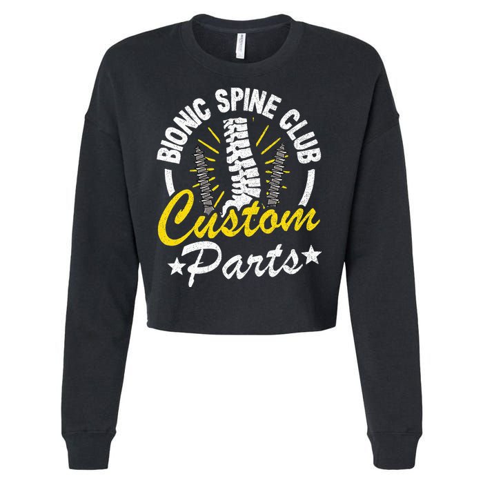 Bionic Spine Club Customs Parts Funny Back Surgery Recovery Cropped Pullover Crew
