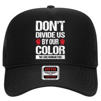Don't Divide Us By Our Color We Are Human Too BLM Hat