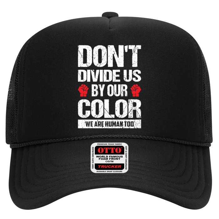 Don't Divide Us By Our Color We Are Human Too BLM Hat