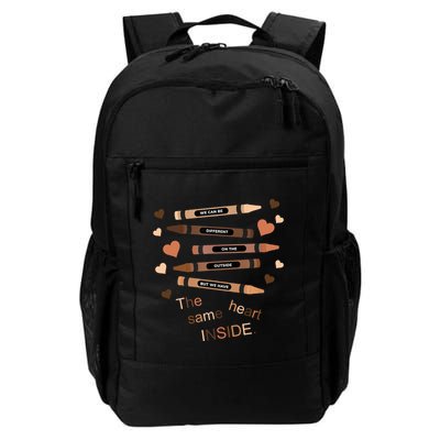 Different On The Outside Same Heart Inside Backpack