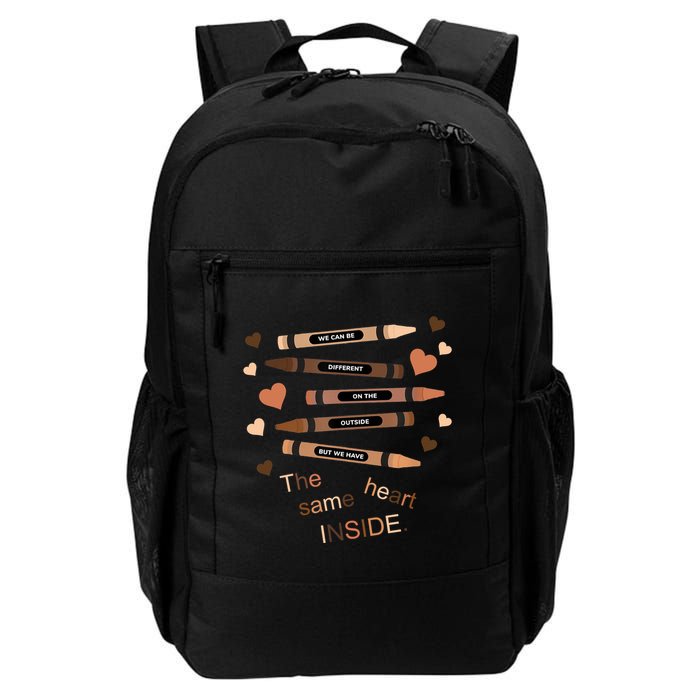 Different On The Outside Same Heart Inside Backpack