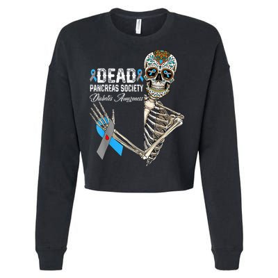Dead Pancreas Society Diabetes Awareness Day Sugar Skeleton Cropped Pullover Crew