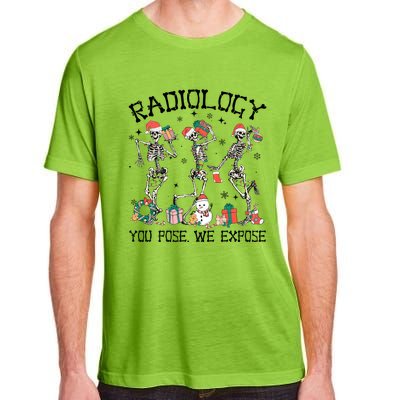 Dancing Skeleton Radiology You Pose We Expose Christmas Xmas Gift Adult ChromaSoft Performance T-Shirt