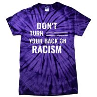 Dont Turn Your Back On Racism Tie-Dye T-Shirt