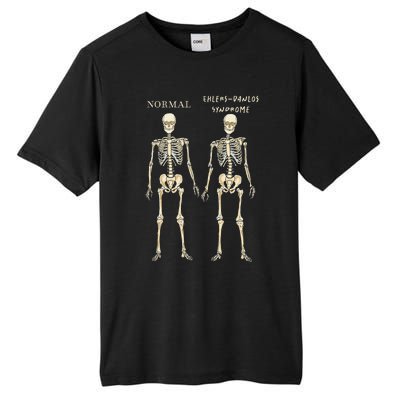 Ehlers Danlos Syndrome Skeletons Zebra Awareness Tall Fusion ChromaSoft Performance T-Shirt