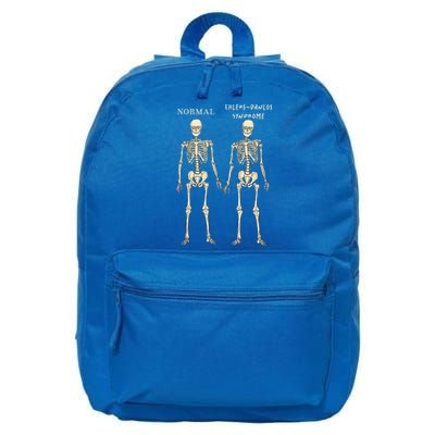 Ehlers Danlos Syndrome Skeletons Zebra Awareness 16 in Basic Backpack