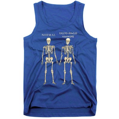 Ehlers Danlos Syndrome Skeletons Zebra Awareness Tank Top