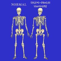 Ehlers Danlos Syndrome Skeletons Zebra Awareness Visor