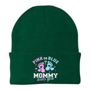 Exciting Gender Reveal Surprise for Expecting Mothers Knit Cap Winter Beanie