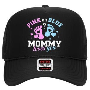 Exciting Gender Reveal Surprise for Expecting Mothers High Crown Mesh Back Trucker Hat