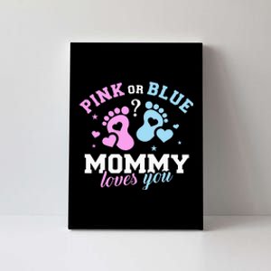 Exciting Gender Reveal Surprise for Expecting Mothers Canvas