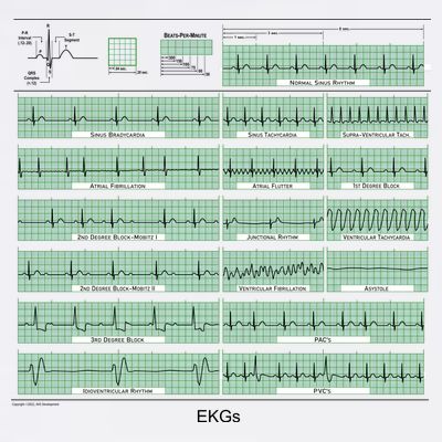EKG Training Mug T-Shirt