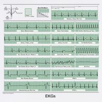 EKG Training Mug Tank Top