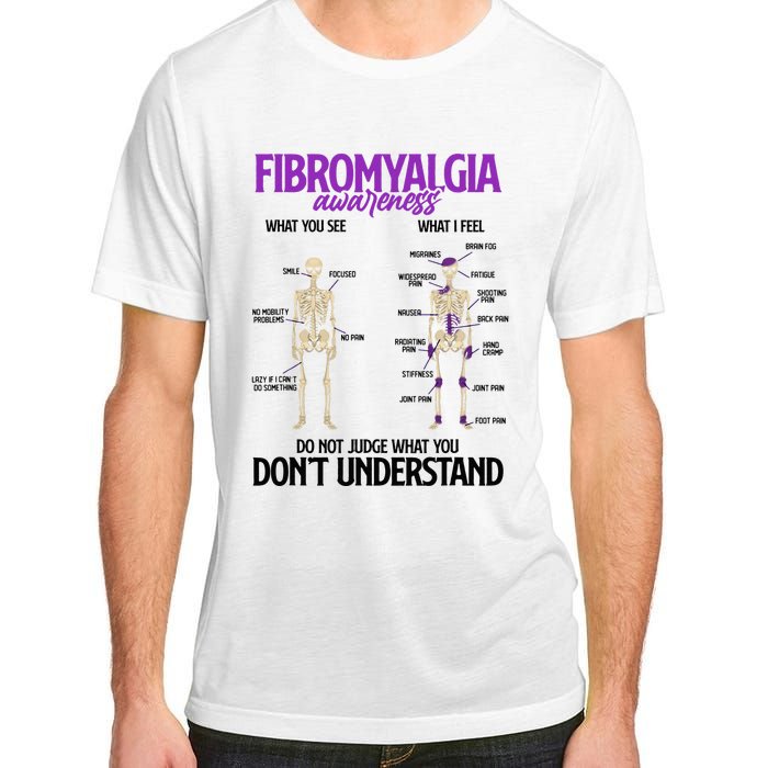 Fibromyalgia Awareness Do Not Judge What You Dont Understand Adult ChromaSoft Performance T-Shirt