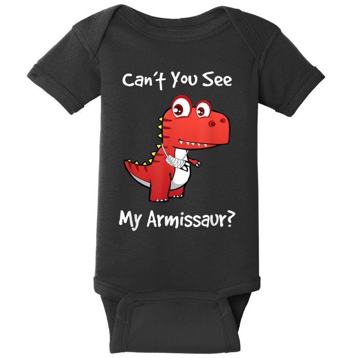 Funny Get Well Broken Arm Gift Dinosaur With A Cast Baby Bodysuit