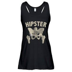 Funny Hip Surgery Gift  Hip Replacement Recovery Ladies Essential Flowy Tank