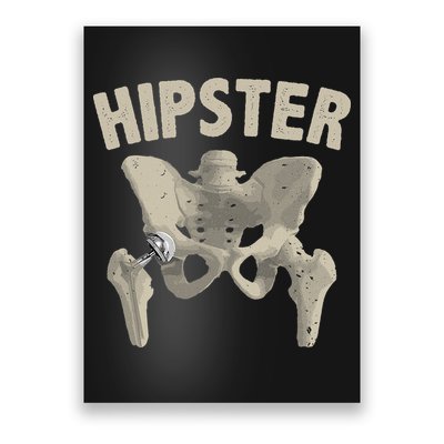 Funny Hip Surgery Gift  Hip Replacement Recovery Poster