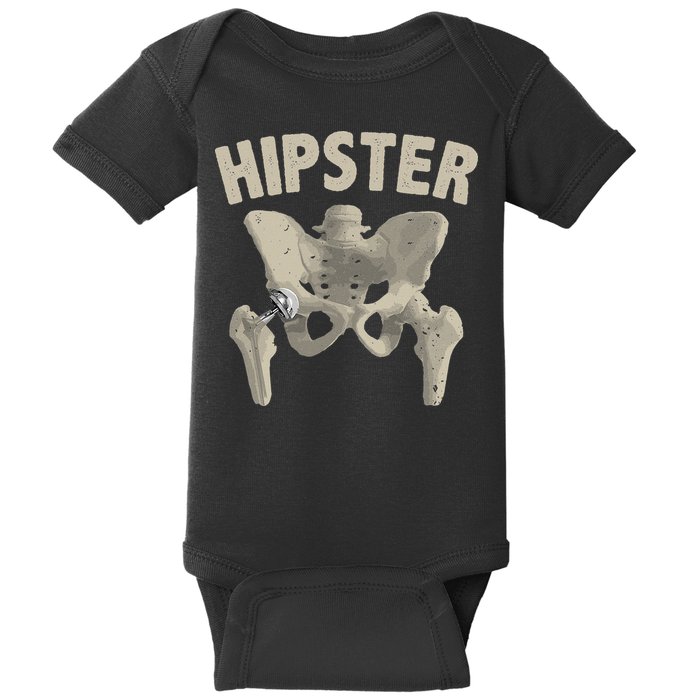 Funny Hip Surgery Gift  Hip Replacement Recovery Baby Bodysuit