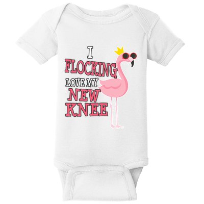 Funny Knee Replacement Surgery Get Well Baby Bodysuit