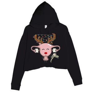 Festive Reindeer Uterus Nurse Speculum Xmas Light Obgyn Crop Fleece Hoodie