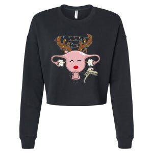 Festive Reindeer Uterus Nurse Speculum Xmas Light Obgyn Cropped Pullover Crew