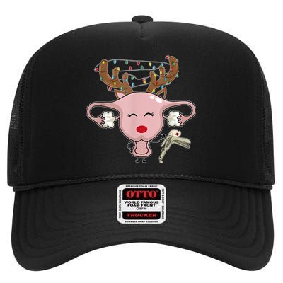 Festive Reindeer Uterus Nurse Speculum Xmas Light Obgyn High Crown Mesh Back Trucker Hat