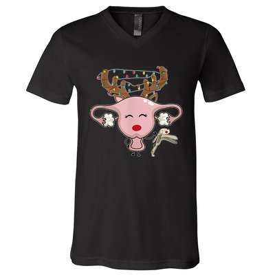 Festive Reindeer Uterus Nurse Speculum Xmas Light Obgyn V-Neck T-Shirt