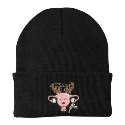 Festive Reindeer Uterus Nurse Speculum Xmas Light Obgyn Beanie