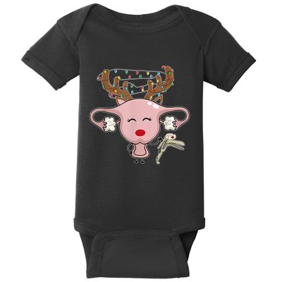 Festive Reindeer Uterus Nurse Speculum Xmas Light Obgyn Baby Bodysuit
