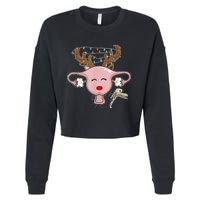 Festive Reindeer Uterus Nurse Speculum Xmas Light Obgyn Cropped Pullover Crew