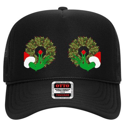 Funny Ugly Christmas Matching Couple Chest Design Trucker Hat