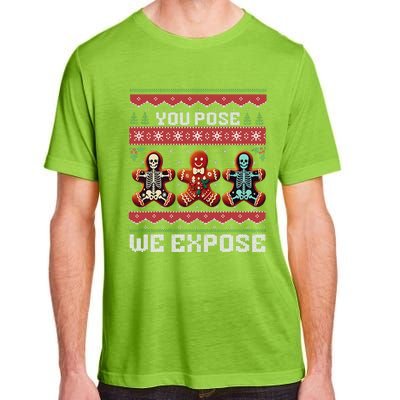 Funny Xray Radiologist Gingerbread Ugly Christmas Sweater Adult ChromaSoft Performance T-Shirt