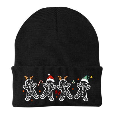 Gingerbread Skeleton Christmas Radiology Shir Xray Tech Beanie