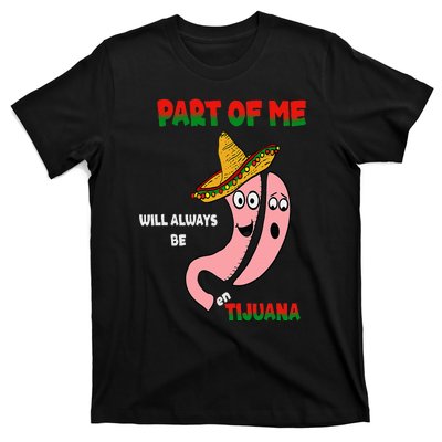 Gastric Surgery Tijuana T-Shirt