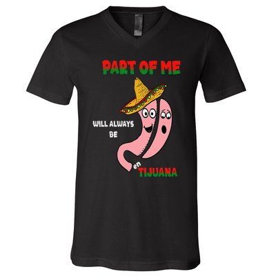 Gastric Surgery Tijuana V-Neck T-Shirt