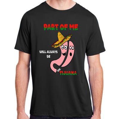 Gastric Surgery Tijuana Adult ChromaSoft Performance T-Shirt