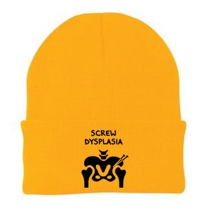 Hip Dysplasia Gift Screw Dysplasia Awareness Funny Gift Knit Cap Winter Beanie