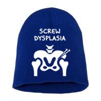 Hip Dysplasia Gift Screw Dysplasia Awareness Funny Gift Short Acrylic Beanie