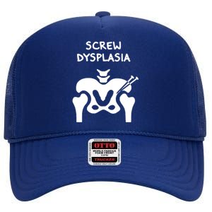 Hip Dysplasia Gift Screw Dysplasia Awareness Funny Gift High Crown Mesh Back Trucker Hat