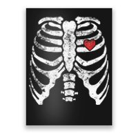 Heart Rib Cage Xray Poster