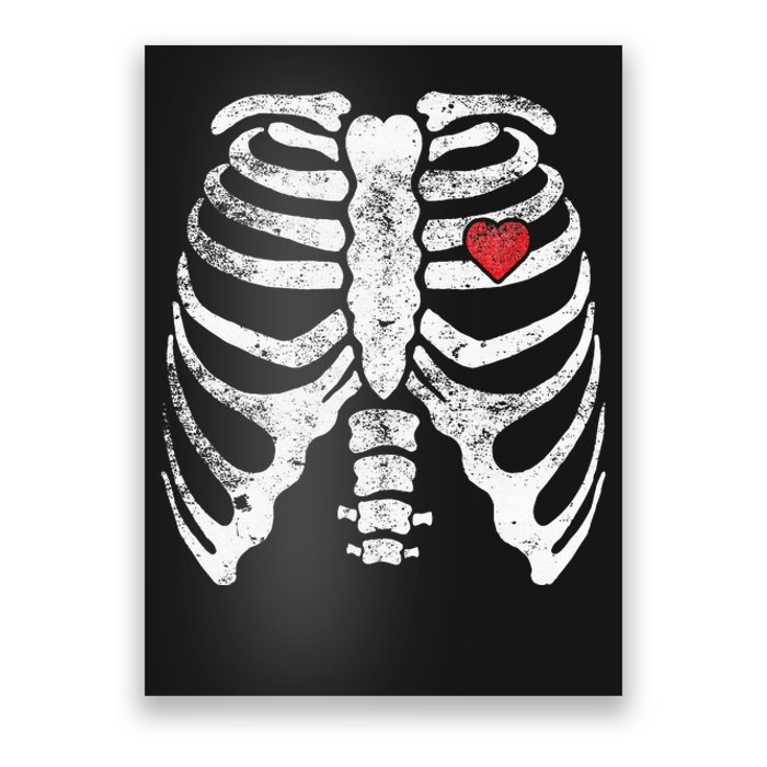 Heart Rib Cage Xray Poster