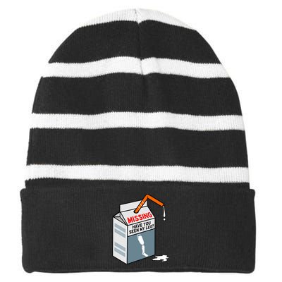 Have You Seen My Leg Fun Ampu Prosthetic Surgery Graphic Striped Beanie with Solid Band