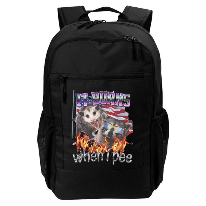 It Burns When I Pee Possum Raccoon Funny Backpack