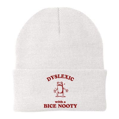 Iswearimnothigh Dyslexic With A Bice Nooty Frog Knit Cap Winter Beanie